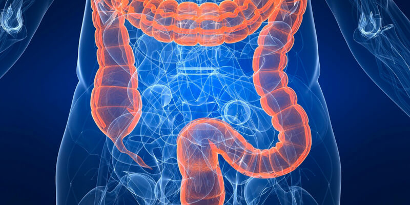 Colite: alimenti consigliati e rimedi naturali